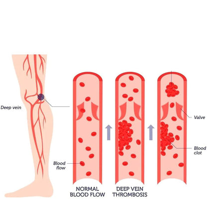 مشد ضاغط بالحرارة للركبة و الساق